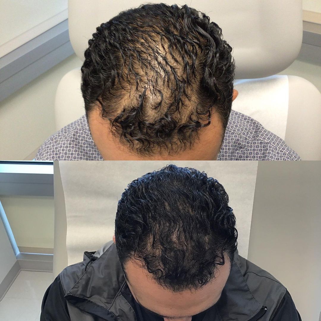 HairGlow™ — Revitaliza y fortalece tu cabello