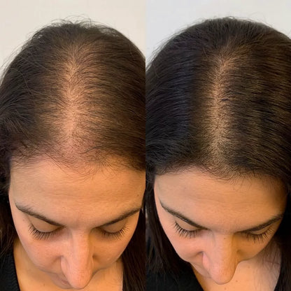 HairGlow™ — Revitaliza y fortalece tu cabello